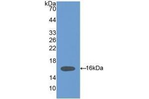 Detection of Recombinant HPA, Mouse using Polyclonal Antibody to Heparanase (HPSE) (HPSE antibody  (AA 280-412))