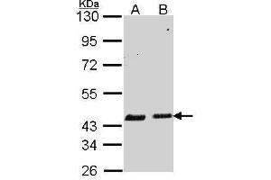 WB Image Sample (30 ug of whole cell lysate) A: A549 B: Hela 10% SDS PAGE antibody diluted at 1:1000 (SERPINB6 antibody  (Internal Region))
