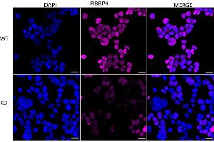 Immunocytochemical staining of HeLa cells using RBBP4 antibody (ABIN7800185), 1:1,000), Top panel: wild-type (WT), Bottom panal: RBBP4 shRNA knockdown (KD). (Recombinant Retinoblastoma Binding Protein 4 antibody)