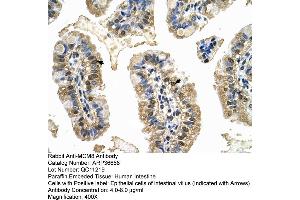 Human Intestine (MCM8 antibody  (C-Term))
