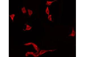 ABIN6274919 staining HeLa by IF/ICC. (BMP3 antibody  (Internal Region))