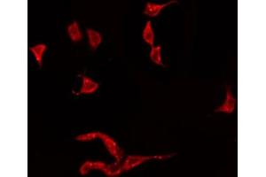 ABIN6274919 staining HeLa by IF/ICC. (BMP3 antibody  (Internal Region))