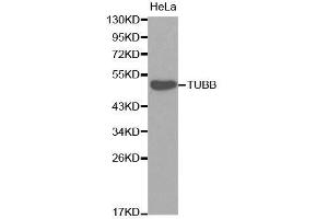 Western blot analysis of extracts of HeLa cells, using TUBB antibody. (TUBB antibody)