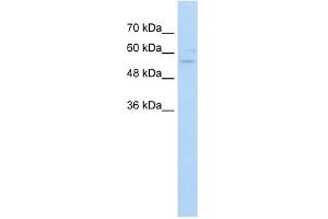 WB Suggested Anti-ZNF19 Antibody Titration:  5. (ZNF19 antibody  (C-Term))