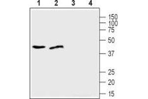 Western blot analysis of human U-87 MG glioblastoma cell lysate (lanes 1 and 3) and human MDA-231 breast adenocarcinoma cell lysate (lanes 2 and 4): - 1,2. (SLC39A1 antibody  (Extracellular, N-Term))