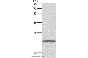 Western blot analysis of Human placenta tissue, using GH1 Polyclonal Antibody at dilution of 1:500 (Growth Hormone 1 antibody)