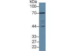 Western blot analysis of Human Jurkat cell lysate, using Rabbit Anti-Mouse LCP2 Antibody (2 µg/ml) and HRP-conjugated Goat Anti-Rabbit antibody (abx400043, 0.