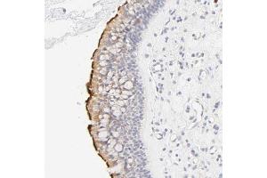 Immunohistochemical staining (Formalin-fixed paraffin-embedded sections) of human nasopharynx shows strong membranous positivity in respiratory epithelial cells.