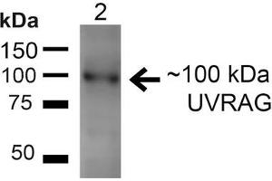 Western blot analysis of Rat Liver showing detection of ~100kDa UVRAG protein using Rabbit Anti-UVRAG Polyclonal Antibody . (UVRAG antibody  (Atto 488))