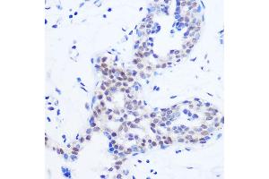 Immunohistochemistry of paraffin-embedded Human breast using SRSF11 Rabbit pAb (ABIN7270215) at dilution of 1:100 (40x lens). (SRSF11 antibody)