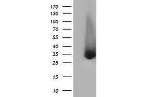 HEK293T cells were transfected with the pCMV6-ENTRY control (Left lane) or pCMV6-ENTRY ERCC1 (Right lane) cDNA for 48 hrs and lysed. (ERCC1 antibody)