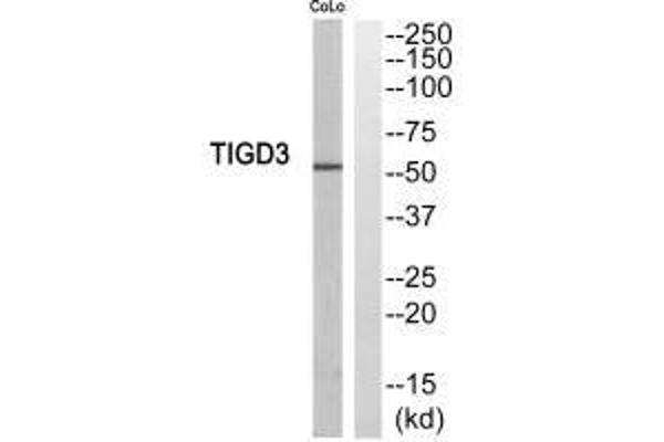 TIGD3 antibody  (C-Term)