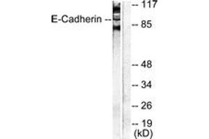 Western blot analysis of extracts from NIH-3T3 cells, using Cadherin-pan Antibody. (Cadherin antibody  (AA 833-882))