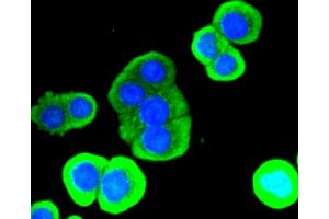 Immunofluorescence analysis of CRC cells using LYZ antibody. (LYZ antibody)