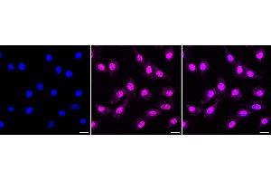 Immunocytochemical staining of C2C12 cells with ASH2L antibody (ABIN7800326), 1:1,000). (Recombinant ASH2L antibody)