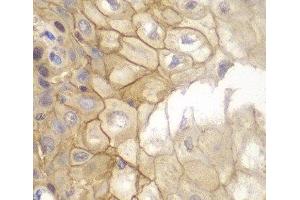 Immunohistochemistry of paraffin-embedded Human esophagus using IL7R Polyclonal Antibody at dilution of 1:100 (40x lens). (IL7R antibody)