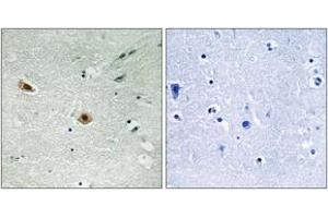 Immunohistochemistry analysis of paraffin-embedded human brain, using Retinoblastoma (Phospho-Ser608) Antibody. (Retinoblastoma Protein (Rb) antibody  (pSer608))