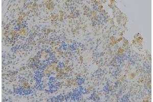 ABIN6278483 at 1/100 staining Human lymph node tissue by IHC-P. (IL4 Receptor antibody  (N-Term))