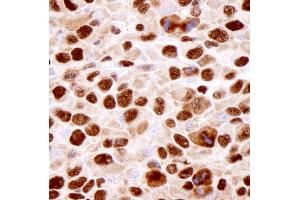 Immunohistochemistry (IHC) image for anti-Heterogeneous Nuclear Ribonucleoprotein K (HNRNPK) (C-Term) antibody (ABIN7448598) (HNRNPK antibody  (C-Term))