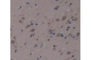 #VALUE! (AHRR antibody  (AA 1-182))