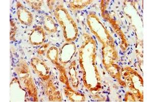 Immunohistochemistry of paraffin-embedded human kidney tissue using ABIN7154587 at dilution of 1:100 (GEM antibody  (AA 1-150))