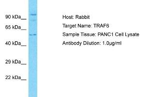 Host: Rabbit Target Name: TRAF6 Sample Type: PANC1 Whole Cell lysates Antibody Dilution: 3. (TRAF6 antibody  (C-Term))