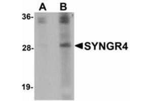 Image no. 1 for anti-Synaptogyrin 4 (SYNGR4) (N-Term) antibody (ABIN478102)