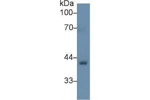 Western Blot; Sample: Rat Skin lysate; Primary Ab: 1µg/ml Rabbit Anti-Human BGN Antibody Second Ab: 0. (Biglycan antibody  (AA 49-182))