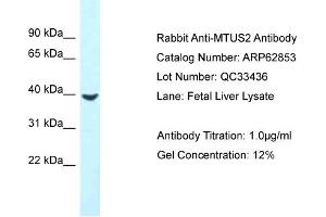 Western Blotting (WB) image for anti-Microtubule-associated Tumor Suppressor Candidate 2 (MTUS2) (C-Term) antibody (ABIN2789268) (CAZIP antibody  (C-Term))