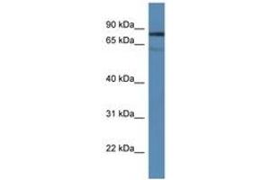Image no. 1 for anti-Tyrosyl-DNA Phosphodiesterase 1 (TDP1) (AA 350-399) antibody (ABIN6746494) (TDP1 antibody  (AA 350-399))