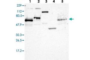 Western blot analysis of Lane 1: RT-4, Lane 2: U-251 MG, Lane 3: Human Plasma, Lane 4: Liver, Lane 5: Tonsil with ETV3 polyclonal antibody  at 1:250-1:500 dilution. (ETV3 antibody)