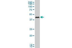 CSNK1G2 monoclonal antibody (M02), clone 2E6 Western Blot analysis of CSNK1G2 expression in Hela S3 NE . (Casein Kinase 1 gamma 2 antibody  (AA 1-415))