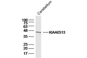 Mouse cerebellum lysates probed with KIAA0513 Polyclonal Antibody, Unconjugated  at 1:300 dilution and 4˚C overnight incubation.