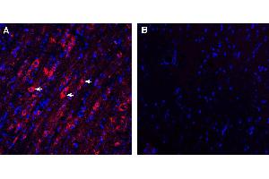 Expression of V1aR in rat medial septum.
