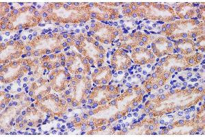 Immunohistochemistry of paraffin-embedded Mouse kidney using HPGD Polyclonal Antibody at dilution of 1:200 (HPGD antibody)