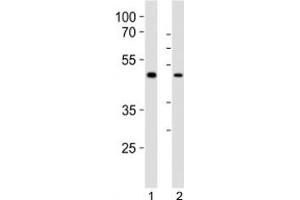 Western blot analysis of lysate from 1) human LNCaP and 2) mouse F9 cell line using Sox17 antibody at 1:1000. (SOX17 antibody  (C-Term))