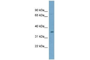 WB Suggested Anti-SLC39A2 Antibody Titration:  0.