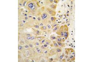 Image no. 1 for anti-Aldehyde Dehydrogenase 2 Family (Mitochondrial) (ALDH2) (AA 325-355) antibody (ABIN356918) (ALDH2 antibody  (AA 325-355))