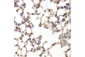 Immunohistochemistry of paraffin-embedded Mouse lung using ALOX15B antibody at dilution of 1:100 (x400 lens). (ALOX15B antibody)