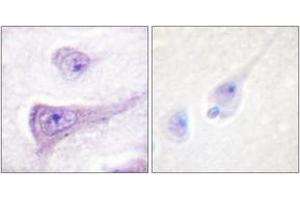 Immunohistochemistry analysis of paraffin-embedded human brain, using WASP (Phospho-Tyr290) Antibody. (WASP antibody  (pTyr290))