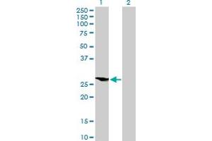 Western Blot analysis of HOXB9 expression in transfected 293T cell line by HOXB9 MaxPab polyclonal antibody. (HOXB9 antibody  (AA 1-250))
