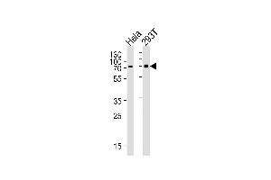 Western blot analysis of lysates from Hela, 293T cell line (from left to right), using SNX1 Antibody at 1:1000 at each lane. (Sorting Nexin 1 antibody  (C-Term))