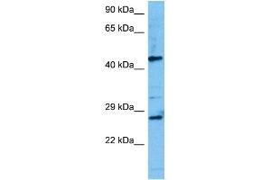 Host:  Mouse  Target Name:  TCF7  Sample Tissue:  Mouse Testis  Antibody Dilution:  1ug/ml (TCF7 antibody  (N-Term))