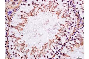 Formalin-fixed and paraffin embedded rat testis labeled with Anti-MAK Polyclonal Antibody, Unconjugated  at 1:200 followed by conjugation to the secondary antibody and DAB staining. (MAK antibody  (AA 101-200))