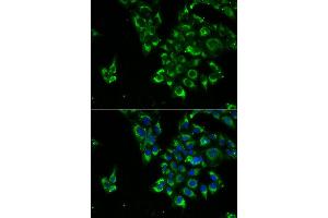 Immunofluorescence analysis of U2OS cell using TSHB antibody. (TSHB antibody)