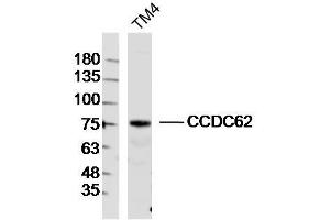 TM4 lysates probed with CCDC62 Polyclonal Antibody, Unconjugated  at 1:300 dilution and 4˚C overnight incubation.