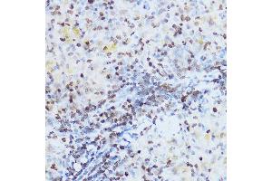 Immunohistochemistry of paraffin-embedded rat spleen using OGT Rabbit pAb (ABIN3022707, ABIN3022708, ABIN3022709 and ABIN6219152) at dilution of 1:100 (40x lens). (OGT antibody  (AA 857-1036))