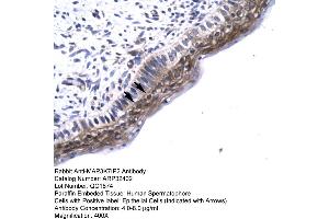 Human Spermatophore (TAB2 antibody  (N-Term))