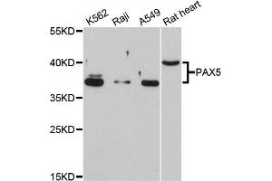 Western blot analysis of extracts of various cell lines, using PAX5 antibody (ABIN5998458) at 1/1000 dilution. (PAX5 antibody)
