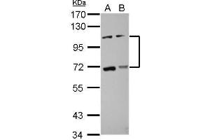 WB Image Sample (30 ug of whole cell lysate) A: HCT116 B: MCF-7 7. (ADAMTS5 antibody  (C-Term))